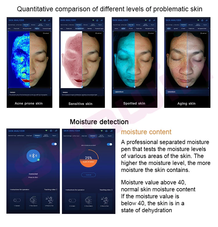 Professional AI Skin Analyzer | 30MP Facial Diagnosis Machine ...