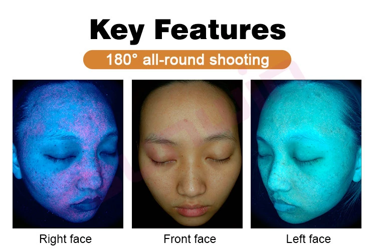Professional AI Skin Analyzer | 30MP Facial Diagnosis Machine ...
