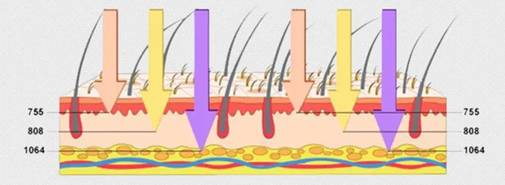 diagram-of-multi-band-laser-penetration-depth