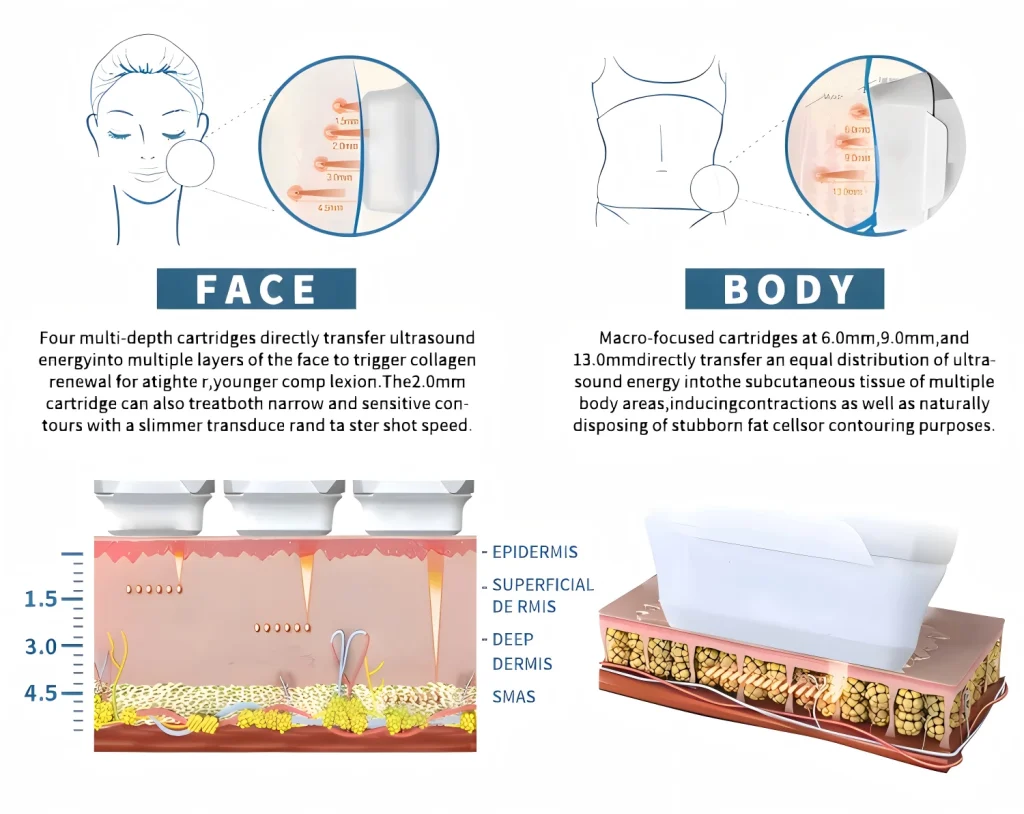 Professional HIFU Machines For Clinics & Spas|Sunwinbeauty
